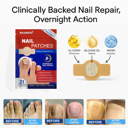 Fungal Nail Renewal Patches